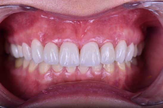 Slider image (9) Care Smile Center